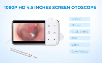 Comment Fonctionne Une Camera Endoscopique Medicale  ?