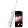 Wireless Intraoral Camera