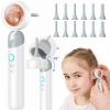 3.9mm Digital Otoscope with 4.5” Screen